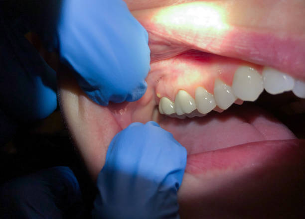 Best Mobile Emergency Dentist in Shenandoah Heights, PA